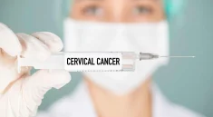 cervical cancer